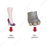 C0415755-Pressure_exerted_by_stiletto_heel_and_elephant_s_foot,_illus-2310886332.jpeg