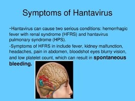 symptoms-of-hantavirus-l.jpg