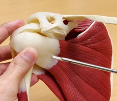 REVERSESHOULDERSURGERY3.jpg