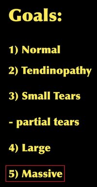 REVERSESHOULDERSURGERY4.jpg