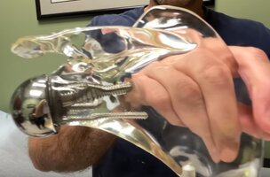 REVERSESHOULDERSURGERY8.jpg