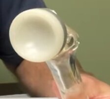 REVERSESHOULDERSURGERY12.jpg